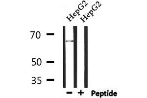 Western blot analysis of extracts from HepG2, using ATIC Antibody. (ATIC Antikörper  (C-Term))