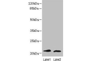 Western blot All lanes: LRRC20 antibody at 1 μg/mL Lane 1: Jurkat whole cell lysate Lane 2: Mouse spleen tissue Secondary Goat polyclonal to rabbit IgG at 1/10000 dilution Predicted band size: 21, 15 kDa Observed band size: 21 kDa (LRRC2 Antikörper  (AA 1-184))