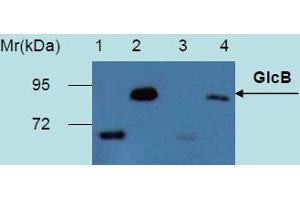 Western Blotting analysis of recombinant protein GlcB produced in Escherichia coli BL21 (lambdaDE3) transfected bacterial culture. (GlcB (M. Tuberculosis) Antikörper)