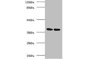 Western blot All lanes: Antigen 85-A antibody at 2 μg/mL Lane 1: Recombinant Mycobacterium tuberculosis Antigen 85-A protein 1 μg Lane 2: Recombinant Mycobacterium tuberculosis Antigen 85-A protein 10 μg Secondary Goat polyclonal to rabbit IgG at 1/10000 dilution Predicted band size: 36 kDa Observed band size: 36 kDa (FBPA (AA 53-331) Antikörper)