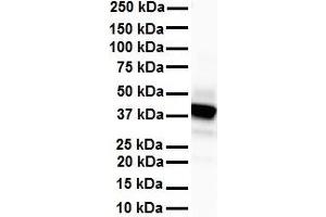 WB Suggested Anti-SLC6A5 antibody Titration: 1 ug/mL Sample Type: Human heart (SLC6A5 Antikörper  (N-Term))