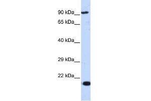 WB Suggested Anti-MCM7 Antibody Titration:  0. (MCM7 Antikörper  (Middle Region))
