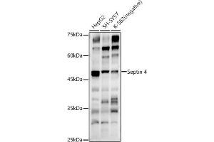 Western blot analysis of extracts of various cell lines, using Septin 4 antibody (ABIN6128476, ABIN6147554, ABIN6147555 and ABIN6214410) at 1:500 dilution. (Septin 4 Antikörper  (AA 1-100))