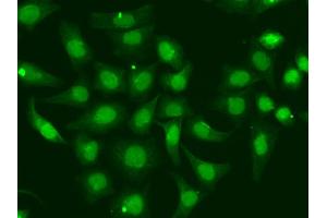 Immunofluorescence analysis of A549 cells using XPA antibody. (XPA Antikörper)