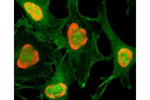 ICC testing of HeLa cells treated with sodium butyrate using recombinant H3K79ac antibody (red). (Rekombinanter Histone 3 Antikörper  (acLys79))