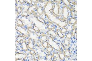 Immunohistochemistry of paraffin-embedded mouse kidney using DEPDC6 antibody (ABIN7266738) at dilution of 1:200 (40x lens).