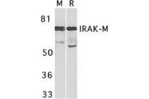 Western blot analysis of IRAK-M in mouse spleen (M) and rat liver (R) tissue lysates with AP30443PU-N IRAK-M antibody at 1 μg/ml.