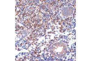 Immunohistochemistry of paraffin-embedded human appendix using V Rabbit mAb (ABIN7271304) at dilution of 1:100 (40x lens). (VAV2 Antikörper)