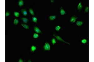 Immunofluorescent analysis of U251 cells using ABIN7145003 at dilution of 1:100 and Alexa Fluor 488-congugated AffiniPure Goat Anti-Rabbit IgG(H+L) (DHX36 Antikörper  (AA 68-181))