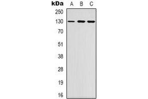 Western blot analysis of EPHB1/2 expression in K562 (A), NIH3T3 (B), HEK293T (C) whole cell lysates. (EPHB1/2 Antikörper)