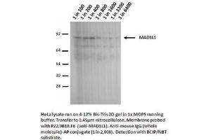 Image no. 2 for anti-Proteasome (Prosome, Macropain) 26S Subunit, Non-ATPase, 14 (PSMD14) antibody (ABIN108607) (PSMD14 Antikörper)