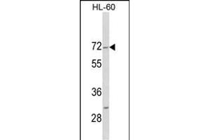 Western blot analysis of HIPK4 C-term (ABIN1882089 and ABIN2841287) in HL-60 cell line lysates (35 μg/lane).