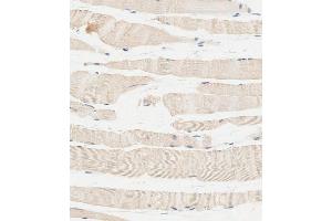 Immunohistochemical analysis of paraffin-embedded human skeletal muscle tissue using C performed on the Leica® BOND RXm. (Glucosylceramidase Antikörper  (Center))