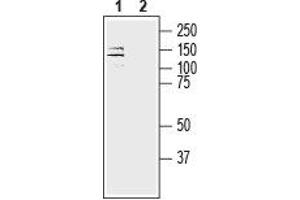 ATP1A3 Antikörper  (Intracellular, N-Term)