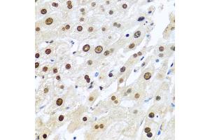 Immunohistochemistry of paraffin-embedded human liver using METTL3 antibody. (METTL3 Antikörper)