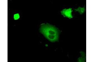 Immunofluorescence (IF) image for anti-Protein Kinase, CGMP-Dependent, Type I (PRKG1) antibody (ABIN2718495)