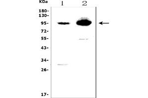 Western blot analysis of EPB41L5 using anti-EPB41L5 antibody (ABIN7601550).