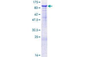 Image no. 1 for Protein S (PROS) (AA 1-676) protein (GST tag) (ABIN1316368)