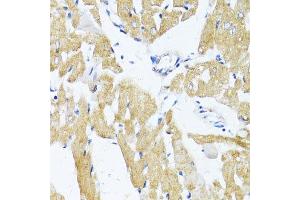 Immunohistochemistry (Paraffin-embedded Sections) (IHC (p)) image for anti-Solute Carrier Family 2 (Facilitated Glucose Transporter), Member 4 (SLC2A4) (C-Term) antibody (ABIN6147963)