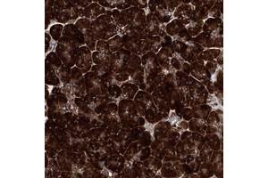 Immunohistochemical staining of human pancreas with MSANTD2 polyclonal antibody  shows strong cytoplasmic positivity in exocrine glandular cells at 1:50-1:200 dilution. (MSANTD2 Antikörper)