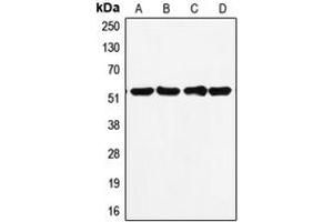 Western blot analysis of p53 expression in MDAMB231 (A), HepG2 (B), MCF7 (C), A431 (D) whole cell lysates. (p53 Antikörper  (C-Term))