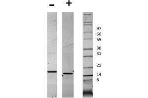 SDS-PAGE (SDS) image for CD40 Ligand (CD40LG) protein (ABIN6699579)