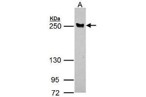 Western Blotting (WB) image for anti-Latent Transforming Growth Factor beta Binding Protein 4 (LTBP4) (N-Term) antibody (ABIN2855142)
