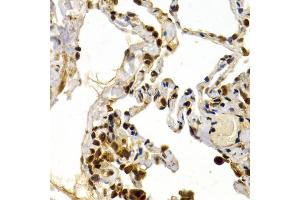Immunohistochemistry of paraffin-embedded human lung using TFDP1 antibody (ABIN5973148) at dilution of 1/200 (40x lens). (DP1 Antikörper)