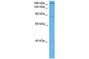 Host:  Rabbit  Target Name:  LAMB1  Sample Tissue:  Mouse Heart  Antibody Dilution:  1ug/ml (Laminin beta 1 Antikörper  (Middle Region))