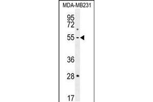 Western blot analysis in MDA-MB231 cell line lysates (35ug/lane). (MMP1 Antikörper  (AA 317-347))