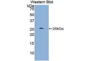 Western blot analysis of the recombinant protein. (Orosomucoid 2 Antikörper  (AA 19-207))