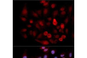 Immunofluorescence analysis of MCF-7 cells using Phospho-ABL1(Y412) Polyclonal Antibody (ABL1 Antikörper  (pTyr412))