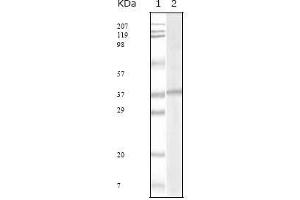 Western blot analysis using KSHV ORF62 mouse mAb against KSHV ORF62 recombinant protein.