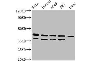 Western Blot Positive WB detected in: Hela whole cell lysate, Jurkat whole cell lysate, A549 whole cell lysate, 293 whole cell lysate, Rat lung tissue All lanes: MAPK1 antibody at 4. (ERK2 Antikörper  (AA 310-360))