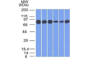 Western Blot of HT20, 293, A431, MCF-7, HepG2 and A549 cell lysates using Catenin, gamma Mouse Monoclonal Antibody (15F11). (JUP Antikörper)
