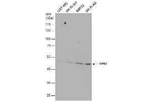 WB Image TPH2 antibody detects TPH2 protein by western blot analysis. (Tryptophan Hydroxylase 2 Antikörper)