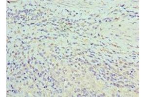 Immunohistochemistry of paraffin-embedded human epityphlon tissue using ABIN7155295 at dilution of 1:100 (ASF1A Antikörper  (AA 1-204))
