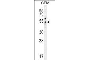 PSL Antibody (C-term) (ABIN655913 and ABIN2845312) western blot analysis in CEM cell line lysates (35 μg/lane).