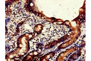 Immunohistochemistry of paraffin-embedded human small intestine tissue using ABIN7161410 at dilution of 1:100