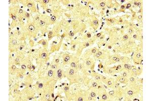 IHC image of ABIN7143616 diluted at 1:350 and staining in paraffin-embedded human liver tissue performed on a Leica BondTM system. (ALT Antikörper  (AA 2-496))