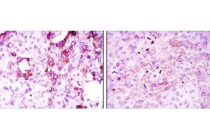 Immunohistochemistry (IHC) image for anti-Tumor Necrosis Factor Receptor Superfamily, Member 11b (TNFRSF11B) antibody (ABIN969440)