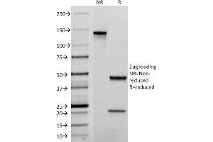 SDS-PAGE Analysis Purified TACSTD2 / TROP2 Mouse Monoclonal Antibody (TACSTD2/2152). (TACSTD2 Antikörper  (AA 31-274))