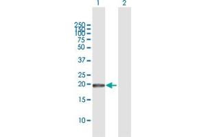 Western Blot analysis of GUK1 expression in transfected 293T cell line by GUK1 MaxPab polyclonal antibody.