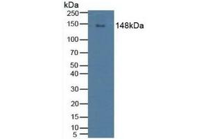 Detection of PLCg2 in Human Raji Cells using Polyclonal Antibody to Phospholipase C Gamma 2, Phosphatidylinositol Specific (PLCg2) (Phospholipase C gamma 2 Antikörper  (AA 930-1152))