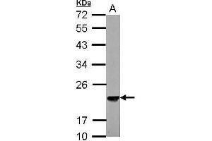 WB Image Sample (30 ug of whole cell lysate) A: NIH-3T3 12% SDS PAGE antibody diluted at 1:3000 (SKP1 Antikörper)