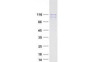 Western Blotting (WB) image for WW Domain Containing E3 Ubiquitin Protein Ligase 2 (WWP2) (Transcript Variant 1) protein (Myc-DYKDDDDK Tag) (ABIN2735649)
