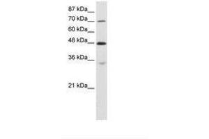 Image no. 2 for anti-Cysteinyl-tRNA Synthetase (CARS) (AA 661-710) antibody (ABIN6736226) (CARS Antikörper  (AA 661-710))