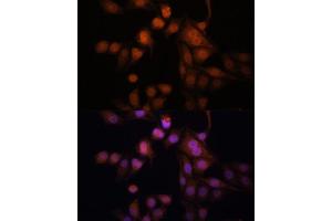 Immunofluorescence analysis of HeLa cells using Twist antibody (ABIN6128846, ABIN6149715, ABIN6149718 and ABIN6223153) at dilution of 1:100.