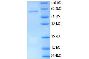 SDS-PAGE (SDS) image for Thrombospondin 3 (THBS3) (AA 24-350), (partial) protein (His tag) (ABIN5713894)