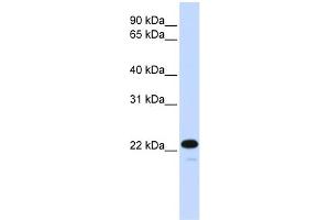 WB Suggested Anti-CDKN1B Antibody Titration:  0. (CDKN1B Antikörper  (C-Term))